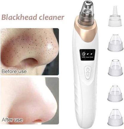 Blackhead Remover Pore Vacuum, Upgraded Electric Facial Pore Cleaner with 5 Suction Power & 5 Probes, 4 Pimple Popper Tools, USB Rechargeable Blackhead Vacuum Kit for Women & Men